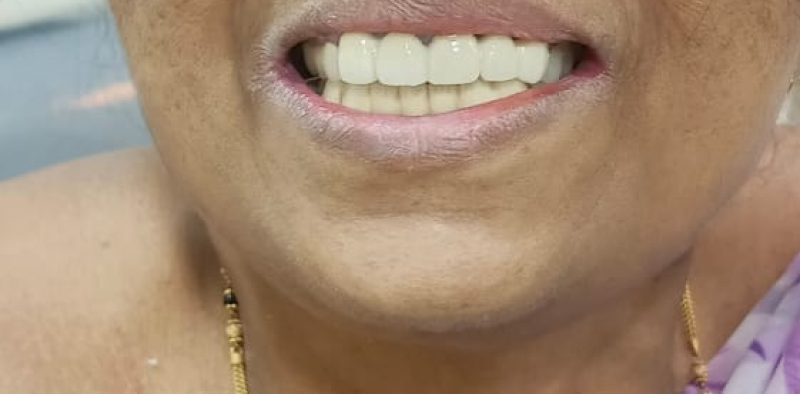 WhatsApp Image 2025-01-26 at 5.03.49 PM (1)